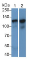 Western Blot; Sample: Lane1: Human Placenta lysate; Lane2: Human Lung lysate Primary Ab: 0.4ug/ml Mouse Anti-Rat CDH5 Antibody Second Ab: 0.2ug/mL HRP-Linked Caprine Anti-Mouse IgG Polyclonal Antibody