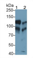 Western Blot; Sample: Lane1: Rat Placenta lysate; Lane2: Rat Lung lysate; Primary Ab: 0.2ug/ml Mouse Anti-Rat CDH5 Antibody; Second Ab: 0.2ug/mL HRP-Linked Caprine Anti-Mouse IgG Polyclonal Antibody