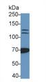 Western Blot; Sample: K562 cell lysate Primary Ab: 0.5ug/ml Mouse Anti-Human PARP Antibody Second Ab: 0.2ug/mL HRP-Linked Caprine Anti-Mouse IgG Polyclonal Antibody