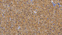 DAB staining on IHC-P; Sample: Porcine Cardiac Muscle Tissue; Primary Ab: 20ug/ml Mouse Anti-Porcine MYO Antibody; Second Ab: 2ug/mL HRP-Linked Caprine Anti-Mouse IgG Polyclonal Antibody