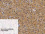 DAB staining on IHC-P; Sample: Porcine Cardiac Muscle Tissue; Primary Ab: 20ug/ml Mouse Anti-Porcine MYO Antibody; Control: Used PBS instead of primary antibody; Second Ab: 2ug/ml HRP-Linked Caprine Anti-Mouse IgG Polyclonal Antibody