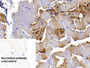 DAB staining on IHC-P; Sample: Porcine Skeletal muscle Tissue; Primary Ab: 20ug/ml Mouse Anti-Porcine MYO Antibody; Control: Used PBS instead of primary antibody; Second Ab: 2ug/ml HRP-Linked Caprine Anti-Mouse IgG Polyclonal Antibody