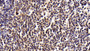 DAB staining on IHC-P; Sample: Human Lymph node Tissue; Primary Ab: 30ug/ml Mouse Anti-Human CD14 Antibody; Second Ab: 2ug/mL HRP-Linked Caprine Anti-Mouse IgG Polyclonal Antibody