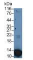 Western Blot; Sample: Human Leukocyte lysate Primary Ab: 2ug/ml Mouse Anti-Human S100A12 Antibody Second Ab: 0.2ug/mL HRP-Linked Caprine Anti-Mouse IgG Polyclonal Antibody