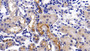 DAB staining on IHC-P; Sample: Mouse Kidney Tissue; Primary Ab: 10ug/ml Rabbit Anti-Mouse ACE2 Antibody; Second Ab: 2ug/mL HRP-Linked Caprine Anti-Rabbit IgG Polyclonal Antibody
