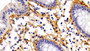 DAB staining on IHC-P; Sample: Human Rectum Tissue; Primary Ab: 10ug/ml Rabbit Anti-Human POSTN Antibody Second Ab: 2ug/mL HRP-Linked Caprine Anti-Rabbit IgG Polyclonal Antibody