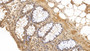 DAB staining on IHC-P; Samples: Human Colon Tissue; Primary Ab: 30ug/ml Mouse Anti-Human GATA3 Antibody; Second Ab: 2ug/mL HRP-Linked Caprine Anti-Mouse IgG Polyclonal Antibody