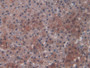 DAB staining on IHC-P; Sample: Rat Adrenal gland Tissue; Primary Ab: 40ug/ml Mouse Anti-Rat IL10 Antibody; Second Ab: 2ug/mL HRP-Linked Caprine Anti-Mouse IgG Polyclonal Antibody