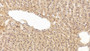 DAB staining on IHC-P; Sample: Human Liver Tissue; Primary Ab: 20ug/ml Mouse Anti-Human TGFb1 Antibody Second Ab: 2ug/mL HRP-Linked Caprine Anti-Mouse IgG Polyclonal Antibody