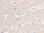 DAB staining on IHC-P; Sample: Human Cerebrum Tissue; Primary Ab: 30ug/ml Mouse Anti-Human NSE Antibody; Second Ab: 2ug/mL HRP-Linked Caprine Anti-Mouse IgG Polyclonal Antibody