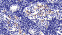 DAB staining on IHC-P; Sample: Rat Lymph node Tissue; Primary Ab: 30ug/ml Mouse Anti-Human IL7R Antibody Second Ab: 2ug/mL HRP-Linked Caprine Anti-Mouse IgG Polyclonal Antibody