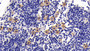 DAB staining on IHC-P; Sample: Rat Lymph node Tissue; Primary Ab: 30ug/ml Mouse Anti-Human IL7R Antibody Second Ab: 2ug/mL HRP-Linked Caprine Anti-Mouse IgG Polyclonal Antibody