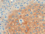 DAB staining on IHC-P; Sample: Mouse Liver Tissue; Primary Ab: 20ug/ml Mouse Anti-Mouse FTH Antibody Second Ab: 2ug/mL HRP-Linked Caprine Anti-Mouse IgG Polyclonal Antibody