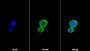 AF488 staining on IF; Sample: THP1 cell; Primary Ab: 20ug/ml Mouse Anti-Human RNASE2 Antibody; Second Ab: 2ug/ml AF488-Linked Caprine Anti-Mouse IgG Polyclonal Antibody
