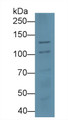 Western Blot; Sample: Hela cell lysate Primary Ab: 1.5ug/ml Mouse Anti-Human DSG3 Antibody Second Ab: 0.2ug/mL HRP-Linked Caprine Anti-Mouse IgG Polyclonal Antibody