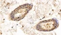 DAB staining on IHC-P; Sample: Rat Skin Tissue; Primary Ab: 30ug/ml Mouse Anti-Human GAL7 Antibody Second Ab: 2ug/mL HRP-Linked Caprine Anti-Mouse IgG Polyclonal Antibody