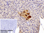 DAB staining on IHC-P; Sample: Rabbit Pancreas Tissue; Primary Ab: 10ug/ml Cavia Anti-Rabbit RBP4 Antibody; Control: Used PBS instead of primary antibody; Second Ab: 2ug/ml HRP-Linked Rabbit Anti-Cavia IgG Polyclonal Antibody