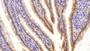 DAB staining on IHC-P; Sample: Rat Small intestine Tissue; Primary Ab: 30ug/ml Mouse Anti-Rat FABP2 Antibody Second Ab: 2ug/mL HRP-Linked Caprine Anti-Mouse IgG Polyclonal Antibody