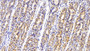 DAB staining on IHC-P; Sample: Human Stomach Tissue; Primary Ab: 30ug/ml Mouse Anti-Human ANTXR2 Antibody; Second Ab: 2ug/mL HRP-Linked Caprine Anti-Mouse IgG Polyclonal Antibody