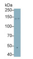 Western Blot; Sample: THP1 cell lysate Primary Ab: 0.2ug/ml Mouse Anti-Human ITGaX Antibody Second Ab: 0.2ug/mL HRP-Linked Caprine Anti-Mouse IgG Polyclonal Antibody