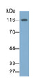 Western Blot; Sample: Rat Small intestine lysate Primary Ab: 0.1ug/ml Rabbit Anti-Rat ASAH2 Antibody Second Ab: 0.2ug/mL HRP-Linked Caprine Anti-Rabbit IgG Polyclonal Antibody