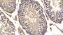DAB staining on IHC-P; Sample: Rat Testis Tissue; Primary Ab: 30ug/ml Mouse Anti-Rat CALR Antibody; Second Ab: 2ug/mL HRP-Linked Caprine Anti-Mouse IgG Polyclonal Antibody
