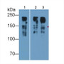 Western Blot; Sample: Lane1: Porcine Skeletal muscle lysate; Lane2: Porcine Esophagus lysate; Lane3: Rat Skeletal muscle lysate; Lane4: Mouse Skeletal muscle lysate Primary Ab: 0.01ug/ml Mouse Anti-Human MYH8 Antibody Second Ab: 0.2ug/mL HRP-Linked Caprine Anti-Mouse IgG Polyclonal Antibody