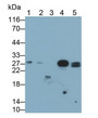 Western Blot; Sample: Lane1: Rat Heart lysate; Lane2: Rat Skeletal muscle lysate; Lane3: Rat Kidney lysate; Lane4: Rat Cerebrum lysate; Lane5: HepG2 cell lysate Primary Ab: 0.2ug/ml Mouse Anti-Human EPDR1 Antibody Second Ab: 0.2ug/mL HRP-Linked Caprine Anti-Mouse IgG Polyclonal Antibody