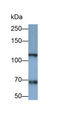 Western Blot; Sample: Human Platelet lysate Primary Ab: 0.5ug/ml Mouse Anti-Human ITGa2B Antibody Second Ab: 0.2ug/mL HRP-Linked Caprine Anti-Mouse IgG Polyclonal Antibody