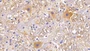 DAB staining on IHC-P; Sample: Rat Spinal cord Tissue; Primary Ab: 20ug/ml Mouse Anti-Human MAP2 Antibody Second Ab: 2ug/mL HRP-Linked Caprine Anti-Mouse IgG Polyclonal Antibody
