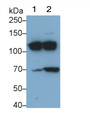 Western Blot; Sample: Lane1: Human Serum; Lane2: Human Plasma Primary Ab: 0.4ug/ml Mouse Anti-Human C3a Antibody Second Ab: 0.2ug/mL HRP-Linked Caprine Anti-Mouse IgG Polyclonal Antibody