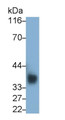 Western Blot; Sample: Jurkat cell lysate Primary Ab: 0.4ug/ml Mouse Anti-Human CD7 Antibody Second Ab: 0.2ug/mL HRP-Linked Caprine Anti-Mouse IgG Polyclonal Antibody