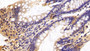DAB staining on IHC-P; Sample: Rat Colon Tissue; Primary Ab: 20ug/ml Mouse Anti-Human CASP6 Antibody; Second Ab: 2ug/mL HRP-Linked Caprine Anti-Mouse IgG Polyclonal Antibody