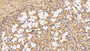 DAB staining on IHC-P; Sample: Porcine Stomach Tissue; Primary Ab: 30ug/ml Mouse Anti-Human YWHAz Antibody; Second Ab: 2ug/mL HRP-Linked Caprine Anti-Mouse IgG Polyclonal Antibody
