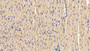 DAB staining on IHC-P; Sample: Rat Cardiac Muscle Tissue; Primary Ab: 30ug/ml Mouse Anti-Human Des Antibody Second Ab: 2ug/mL HRP-Linked Caprine Anti-Mouse IgG Polyclonal Antibody
