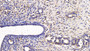 DAB staining on IHC-P; Sample: Rat Uterus Tissue; Primary Ab: 30ug/ml Mouse Anti-Rat SFRP1 Antibody Second Ab: 2ug/mL HRP-Linked Caprine Anti-Mouse IgG Polyclonal Antibody