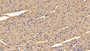 DAB staining on IHC-P; Sample: Rat Cardiac Muscle Tissue; Primary Ab: 30ug/ml Mouse Anti-Rat SFRP1 Antibody; Second Ab: 2ug/mL HRP-Linked Caprine Anti-Mouse IgG Polyclonal Antibody