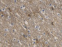 DAB staining on IHC-P; Sample: Human Cerebrum Tissue; Primary Ab: 20ug/ml Mouse Anti-Human AQP4 Antibody Second Ab: 2ug/mL HRP-Linked Caprine Anti-Mouse IgG Polyclonal Antibody