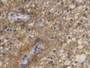 DAB staining on IHC-P; Sample: Human Glioma Tissue; Primary Ab: 20ug/ml Mouse Anti-Human AQP4 Antibody; Second Ab: 2ug/mL HRP-Linked Caprine Anti-Mouse IgG Polyclonal Antibody