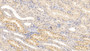 DAB staining on IHC-P; Sample: Human Kidney Tissue; Primary Ab: 10ug/ml Mouse Anti-Human GLa Antibody; Second Ab: 2ug/mL HRP-Linked Caprine Anti-Mouse IgG Polyclonal Antibody