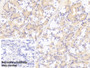 DAB staining on IHC-P;Sample: Porcine Stomach TissuePrimary Ab: 30ug/ml Mouse Anti-Human PGA AntibodyControl: Used PBS instead of primary antibodySecond Ab: 2ug/ml HRP-Linked Caprine Anti-Mouse IgG Polyclonal Antibody