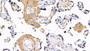 DAB staining on IHC-P; Sample: Human Placenta Tissue; Primary Ab: 30ug/ml Mouse Anti-Human FGB Antibody Second Ab: 2ug/mL HRP-Linked Caprine Anti-Mouse IgG Polyclonal Antibody