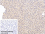 DAB staining on IHC-P; Sample: Porcine Liver Tissue; Primary Ab: 30ug/ml Mouse Anti-Human FGB Antibody; Control: Used PBS instead of primary antibody; Second Ab: 2ug/ml HRP-Linked Caprine Anti-Mouse IgG Polyclonal Antibody