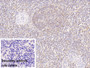 DAB staining on IHC-P; Sample: Porcine Spleen Tissue; Primary Ab: 20ug/ml Mouse Anti-Human MMP7 Antibody; Control: Used PBS instead of primary antibody; Second Ab: 2ug/ml HRP-Linked Caprine Anti-Mouse IgG Polyclonal Antibody