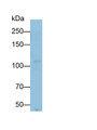 Western Blot; Sample: HCT116 cell lysate; Primary Ab: 1ug/ml Mouse Anti-Human INSR Antibody; Second Ab: 0.2ug/ml HRP-Linked Caprine Anti-Mouse IgG Polyclonal Antibody