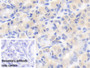 DAB staining on IHC-P; Sample: Porcine Stomach Tissue Primary Ab: 20ug/ml Mouse Anti-Human IL12B Antibody Control: Used PBS instead of primary antibody Second Ab: 2ug/ml HRP-Linked Caprine Anti-Mouse IgG Polyclonal Antibody