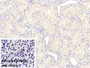 DAB staining on IHC-P; Sample: Porcine Kidney Tissue Primary Ab: 20ug/ml Mouse Anti-Human IL18 Antibody Control: Used PBS instead of primary antibody Second Ab: 2ug/ml HRP-Linked Caprine Anti-Mouse IgG Polyclonal Antibody