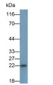Western Blot; Sample: THP1 cell lysate; Primary Ab: 0.2ug/ml Mouse Anti-Human IL18 Antibody; Second Ab: 0.2ug/ml HRP-Linked Caprine Anti-Mouse IgG Polyclonal Antibody