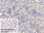 DAB staining on IHC-P; Sample: Porcine Kidney Tissue Primary Ab: 20ug/ml Mouse Anti-Human NPHN Antibody Control: Used PBS instead of primary antibody Second Ab: 2ug/ml HRP-Linked Caprine Anti-Mouse IgG Polyclonal Antibody