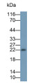 Western Blot; Sample: THP1 cell lysate; Primary Ab: 0.2ug/ml Mouse Anti-Human IL18 Antibody; Second Ab: 0.2ug/ml HRP-Linked Caprine Anti-Mouse IgG Polyclonal Antibody